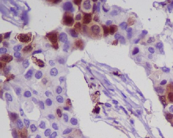 S100A8 Rabbit mAb